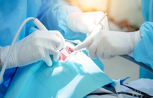 Clínica boutique Dental Madrid – cirugía bucal - Son todos los tratamientos que implique que te hagamos cualquier tipo de extracción o de operación en el medio oral