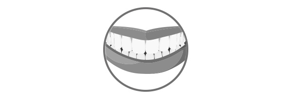 Clínica boutique Dental Madrid – diseño de la sonrisa - Análisis que realizamos para ver que opciones de tratamientos podemos darte para cambiar tu estética dental y mejorarla
